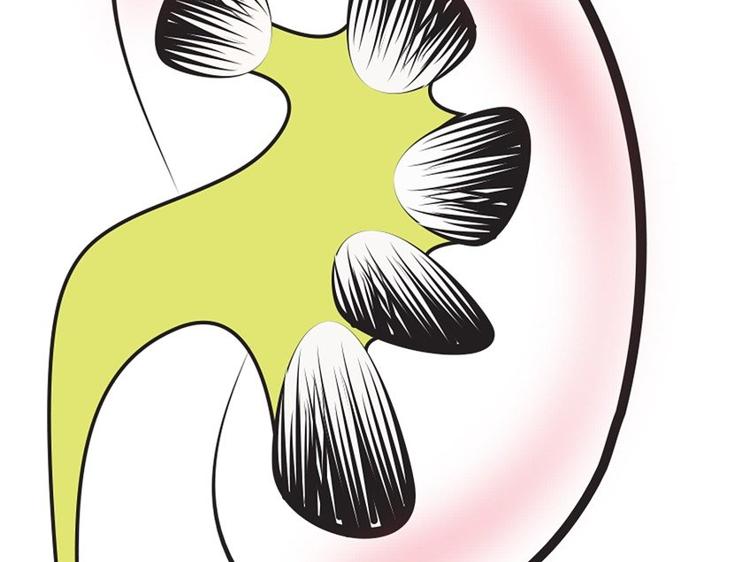 五苓散改善水肿：中医调节水液的经典逻辑与用药指南