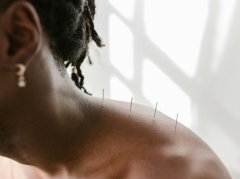 肩颈放血缓解肩周炎？利弊分析+科学应对指南