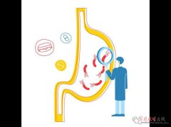胆汁反流性胃炎？中医分2型辨证治，避免盲目用药