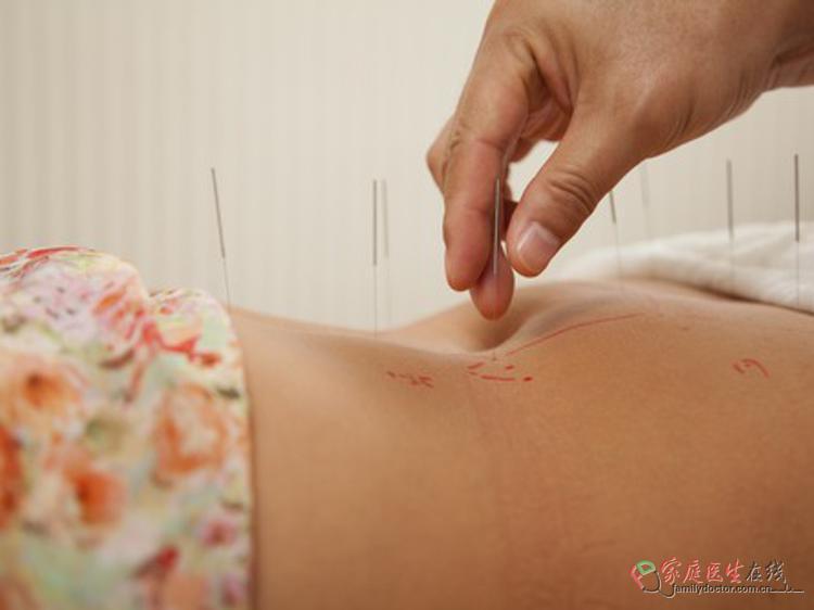 椭圆机运动后腰痛?3种中医调养法帮你温和缓解防复发(图1) 椭圆机运动后腰痛?3种中医调养法帮你温和缓解防复发