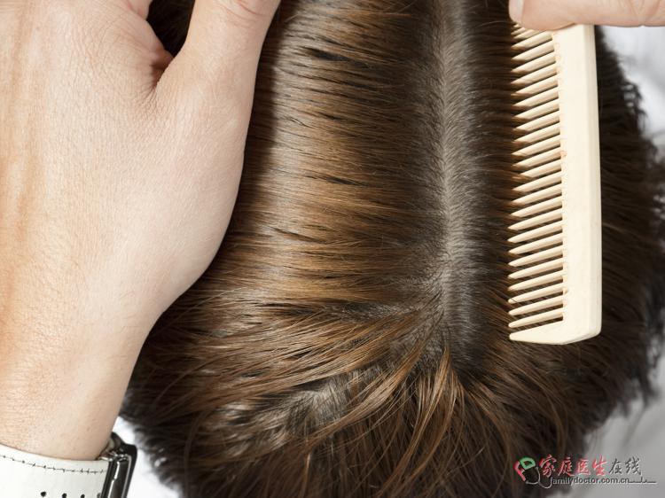 侧柏叶治白发靠谱吗?3个关键问题帮你避坑(图1) 侧柏叶治白发靠谱吗?3个关键问题帮你避坑