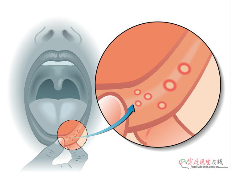舌头中间发红？3种健康信号预警，教你区分调理