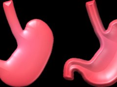 脾胃湿热为啥会导致口臭？这样调更科学