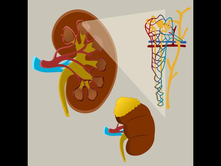 脾肾不足型虚实夹杂：5类信号识别+3步科学调理方案