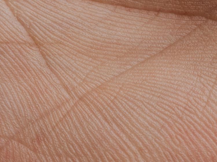 手掌光滑是肝肾亏虚？别被误导！3个科学判断法