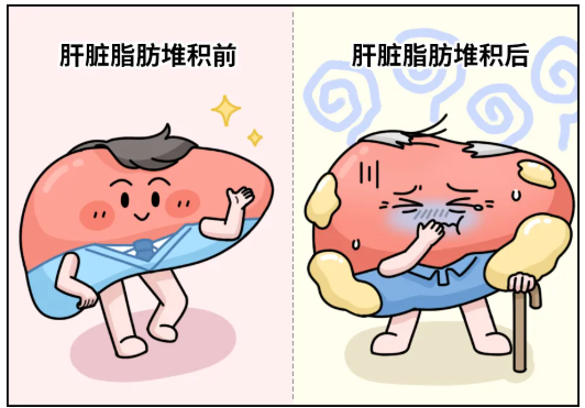 等量糖分不同危害 “喝糖”比“吃糖”更伤身(图6)