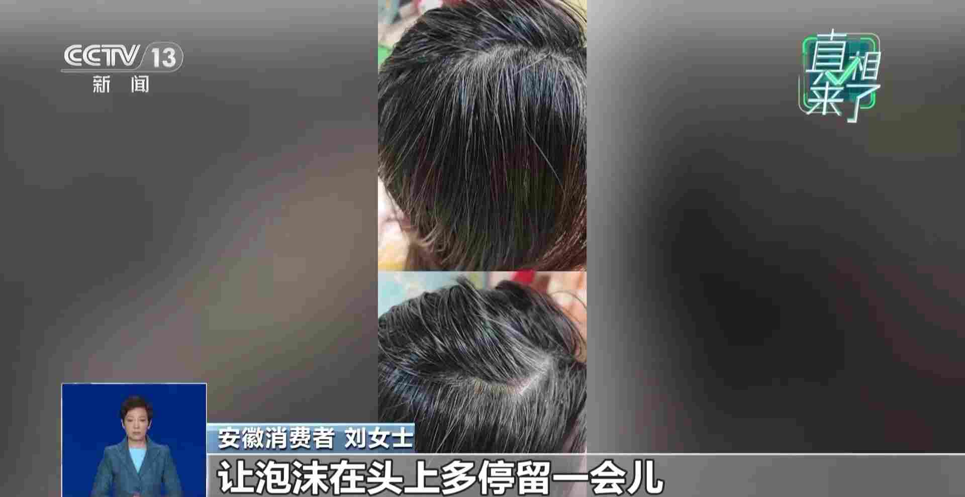 白头发“一洗就能黑”？专家：白发无法逆转(图3)