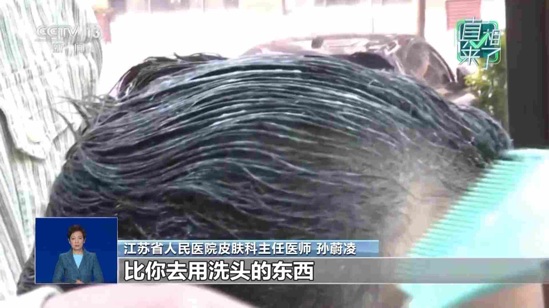 白头发“一洗就能黑”？专家：白发无法逆转(图8)